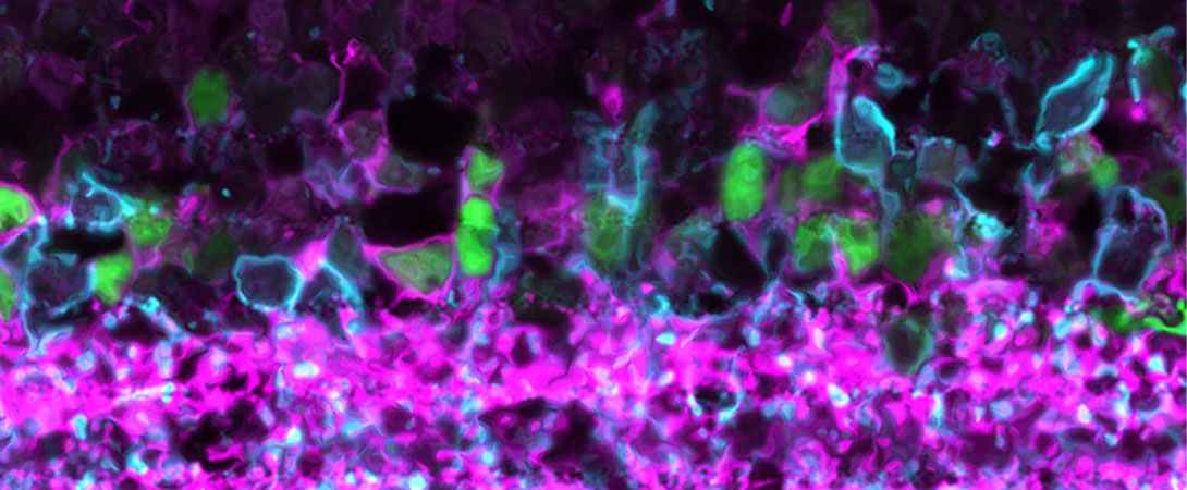 This image shows a retinal section from a mouse in which a subset of amacrine cells was labeled with an antibody against the transcription factor Meis 2 (green), which was identified in a single-cell RNA sequencing expression screen that characterized >60 amacrine cell types. The section was also stained to mark two classes of inhibitory neurons, GABAergic (magenta) and glycinergic (cyan). 
