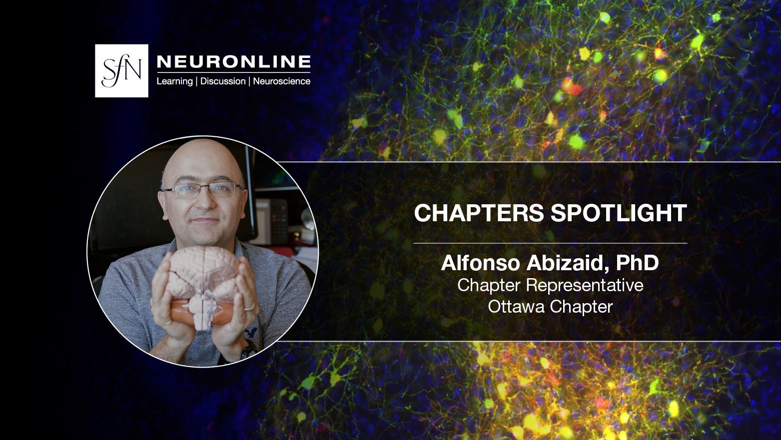 Chapters article thumbnail with Alfonso holding a brain model