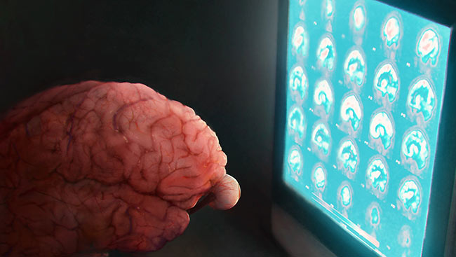 Illustration of a brain looking at a computer screen. 