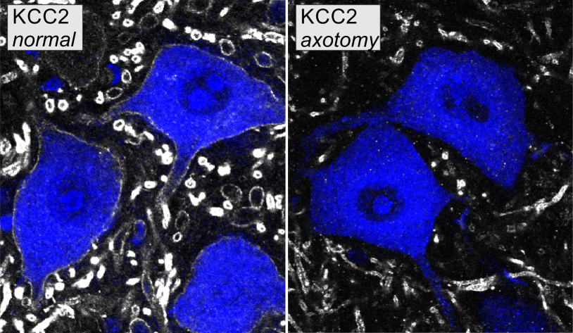 KCC2 on motoneurons retrogradely labeled with Fast Blue from the muscle. The images show normal KCC2 distribution and depletion 14 days after axotomy. The figures correspond to Figures 1A and 1B in Akhter et al., eNeuro, 2019.