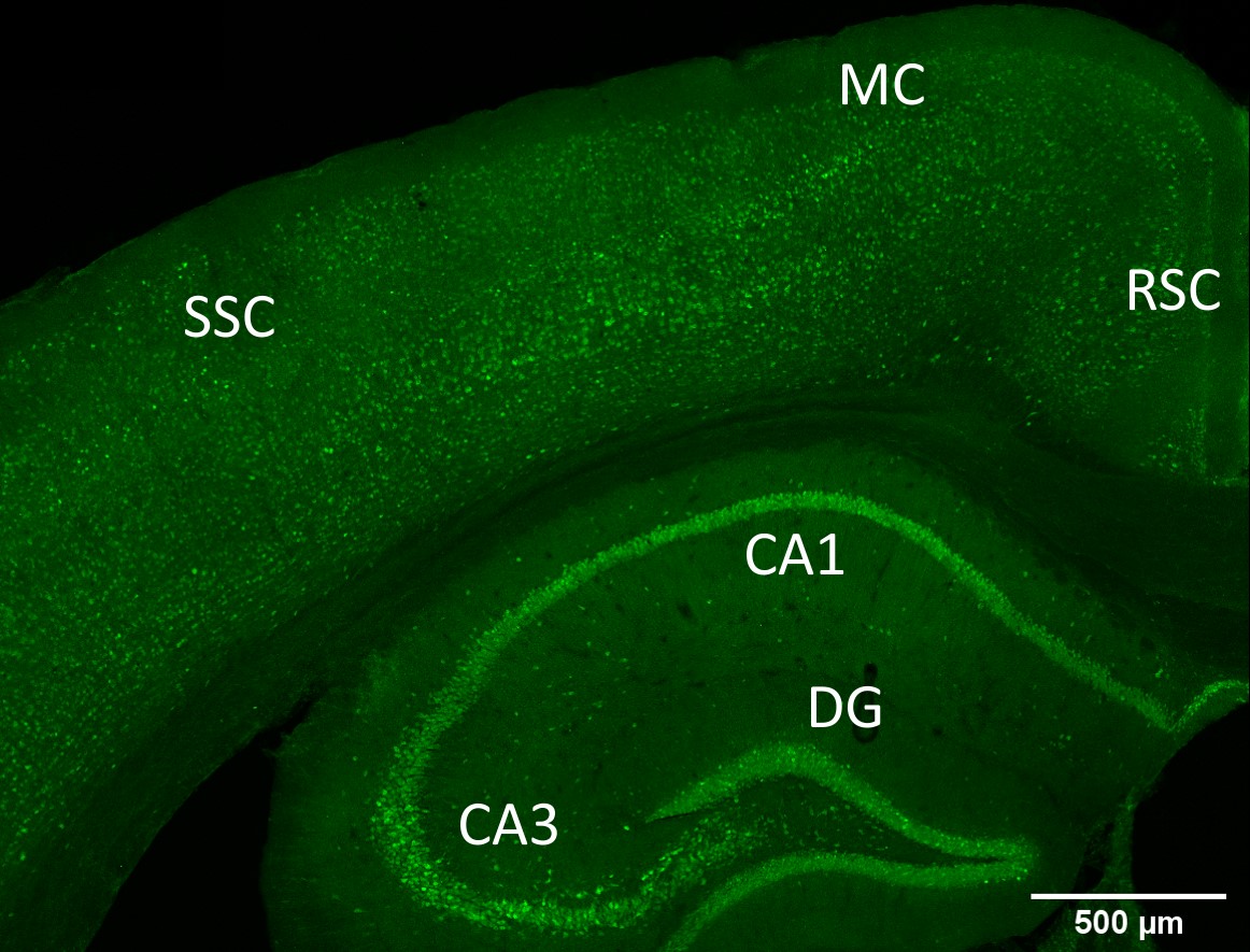 GFP-positive cells in the adult mouse forebrain. Note numerous cells in the hippocampal formation including the dentate gyrus (DG), CA3 and CA1, as well as in the retrosplenial cortex (RSC), the motor and somatosensory cortex (MC and SSC).
