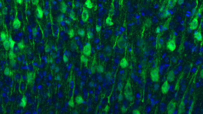 Striatal neurons from embryonic day 17.5 Frizzled3 knock-out mice, stained for dopamineand cAMP-regulated phosphoprotein of 32 kDa (DARPP-32; green). The striatum is normally heavily innervated by meso-diencephalic axons at this developmental stage, but the neurons shown here still await innervation by these projections.