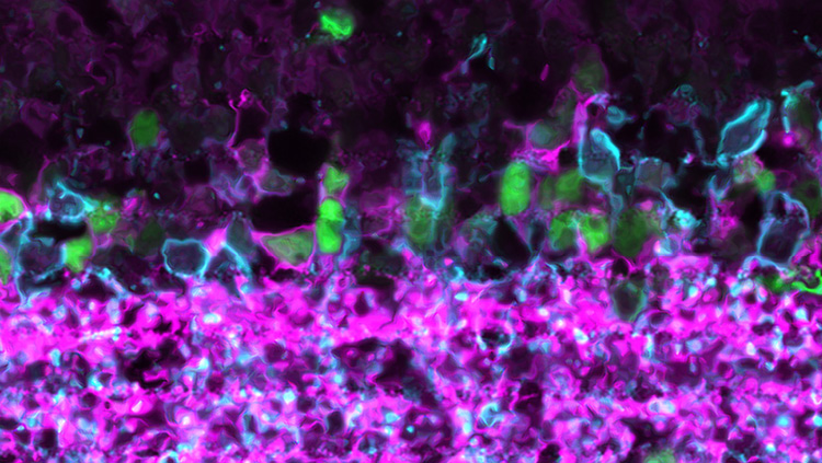 This image shows a retinal section from a mouse in which a subset of amacrine cells was labeled with an antibody against the transcription factor Meis 2 (green), which was identified in a single-cell RNA sequencing expression screen that characterized >60 amacrine cell types. The section was also stained to mark two classes of inhibitory neurons, GABAergic (magenta) and glycinergic (cyan). 