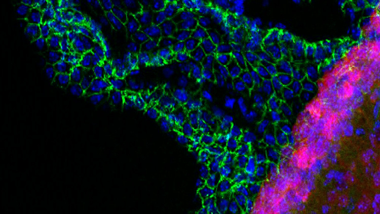 This image shows GFAP-Cre activity (tdTomato/red) in a choroid plexus (marked by β-catenin/green) of a lateral ventricle of mouse brain at postnatal day 7. 