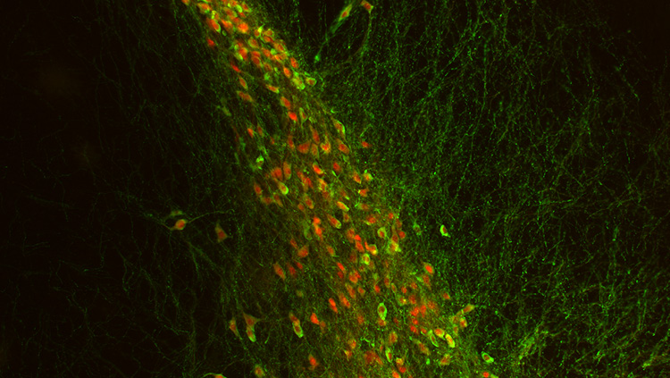 This image shows tyrosine hydroxylase-immunoreactive neurons (green) in substantia nigra pars compacta. These neurons coexpress the dopamine transporter (red). In contrast, less than half of tyrosine-hydroxylase-expressing neurons in the hypothalamus expressed dopamine transporter, and those that don't are required for the autoregulation of growth hormone secretion. 