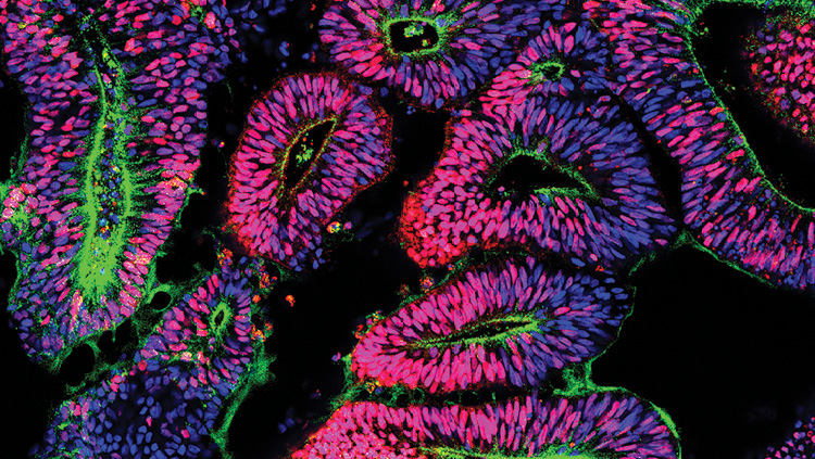2.	This image shows a cross section of a day 28 human forebrain organoid, showing FOXG1-expressing neural precursors (Red), surrounding a ventricle-like structure outlined by N-Cadherin staining (Green). DAPI staining is blue.