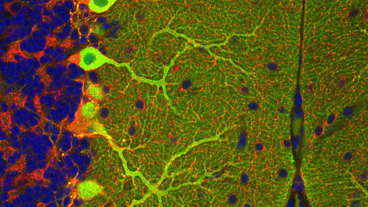 This image shows expression levels of protein kinase Cγ (PKCγ, green) in cerebellar Purkinje cells (labeled with the GABA-synthesizing protein GAD67, red) in a postnatal day 60 mouse. 3-Phosphoinositide-dependent protein kinase-1 is required to maintain PKCγ expression and dendritic arbors in Purkinje cells.