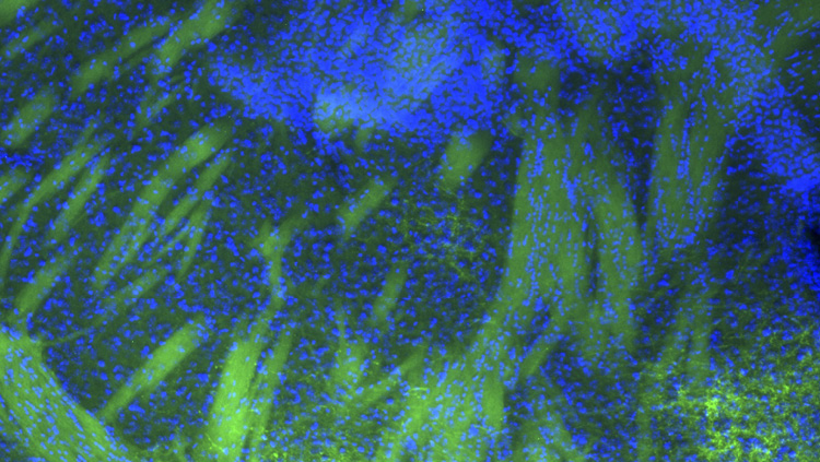 This image shows corticofugal axons (green) projecting from layer 5 of the mouse primary visual cortex to the dorsal striatum. Layer 5 projections from primary visual, primary somatosensory, primary motor, and ventromedial orbitofrontal cortex all have terminal fields within the striatum, among other common targets. Blue is DAPi nuclear stain.