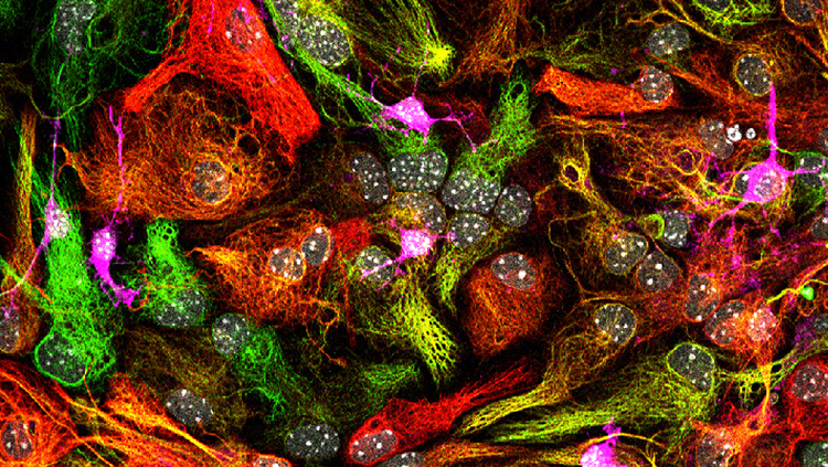 This image shows a neuroprogenitor culture used to study the effect of the phagocytic microglial secretome. Nuclei are shown in white (DAPI), progenitors in green (nestin), astrocytes in red (GFAP) and neuroblasts in magenta (doublecortin). Image credits: Irune Diaz-Aparicio.