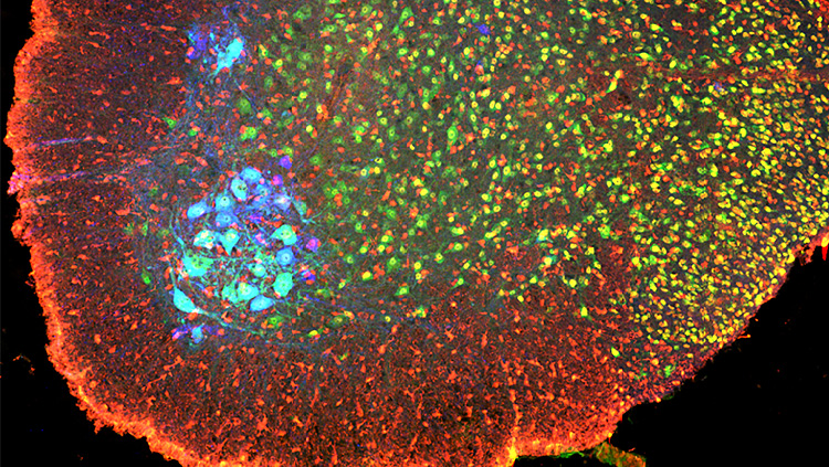 This image shows phosphorylated (inactivated) cofilin (red) in spinal cord. Phosphorylated cofilin is present at high levels in in a broad swathe of embryonic spinal neurons (green), including motor neurons (blue).